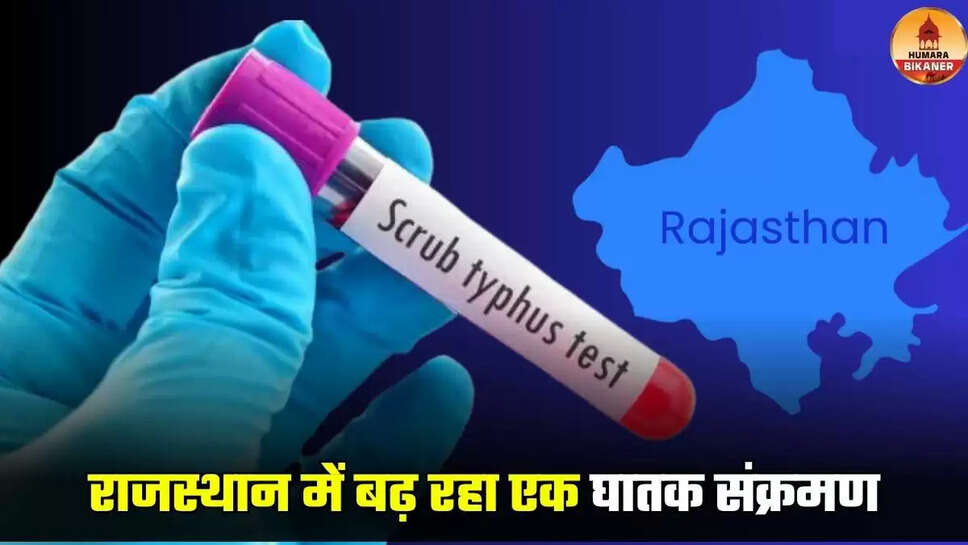 Scrub Typhus in Rajasthan