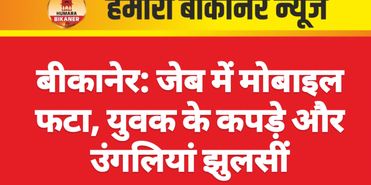 बीकानेर: जेब में मोबाइल फटा, युवक के कपड़े और उंगलियां झुलसीं